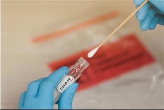 האם יש דבר כזה בדיקת קורונה PCR מהירה?