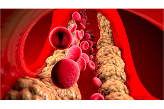 5 גורמים מפתיעים לרמות שומן גבוהות בדם