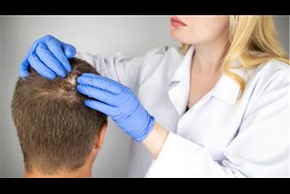 תיקון של השתלת שיער: האם זה אפשרי?