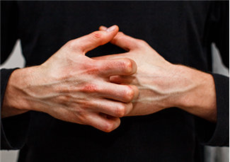 איך להרגיע אלרגיה בעור? מדריך לטיפול מהיר ויעיל