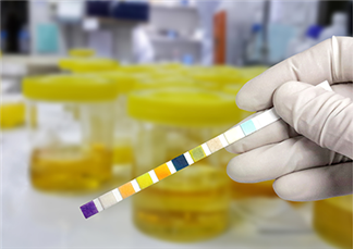 אבנים בכליות: הכל על התסמינים ודרכי האבחון