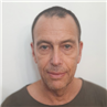ד"ר אודי צינמון אף אוזן גרון וכירורגיית ראש-צוואר