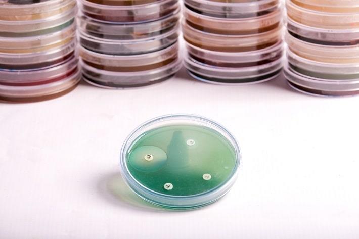 צלוחית פטרי עם תרבית של מיקרואורגניזם, בדיקת תרבית פטריות  