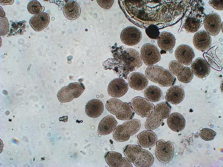 תצלום מיקרוסקופי של פרזיטים מסוג אכינוקוקוס