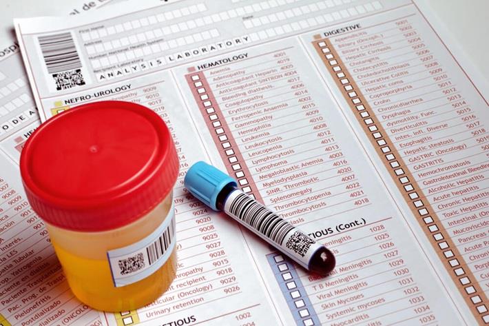 כלי לבדיקת מטנפרינים בשתן METANEPHRINE HPLC URINE