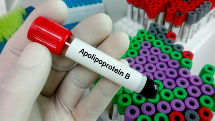 בדיקת דם -פרוקטוזאמין