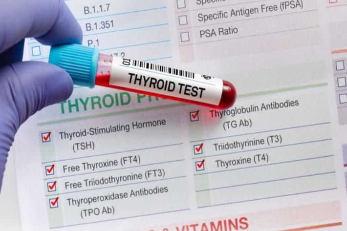 יד מחזיקה מבחנה עם דם לאחר בדיקה של נוגדנים לבלוטת התריס