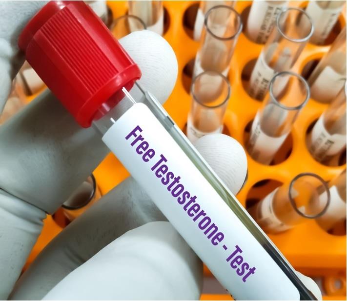 בדיקת טסטוסטרון חופשי