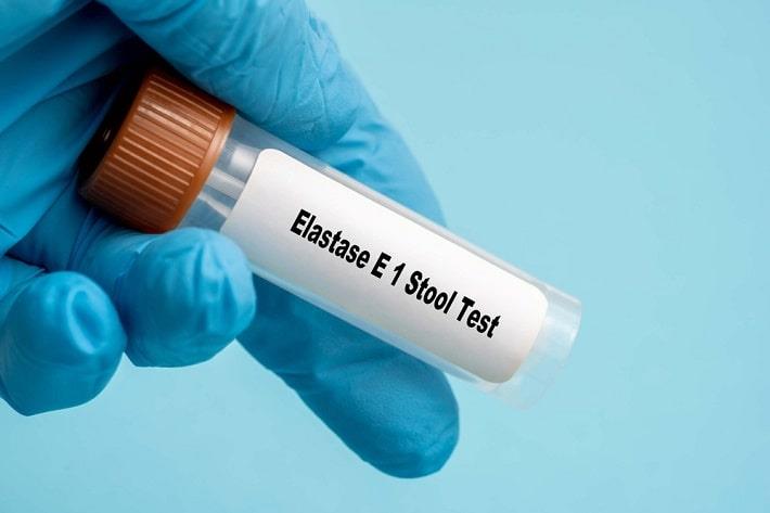 יד אוחזת במבחנה לבדיקת צואה, בדיקת אלסטאז