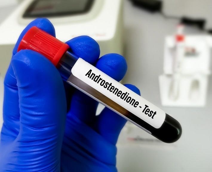 יד אוחזת במבחנה של בדיקת אנדרוסטנדיון בדם 