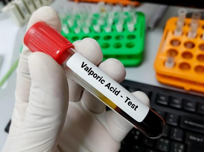 יד אוחזת במבחנה עם דם של בדיקת חומצה ולפרואית בדם   