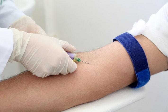 יד של אח לוקחת דגימת דם נוגדנים מזרוע של גבר בעת בדיקת תאים פריאטליים בזק