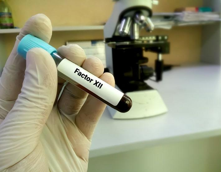 יד אוחזת במבחנה עם דם של בדיקת פקטור קרישה 12