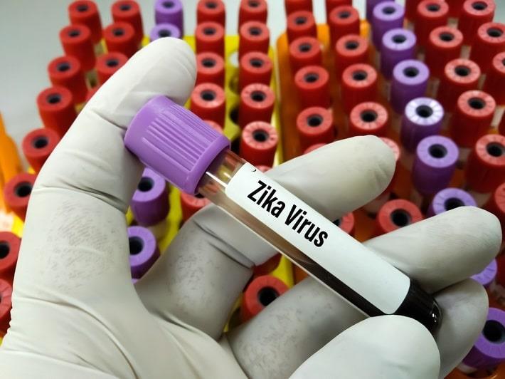 יד אוחזת במבחנת דם של בדיקת זיקה אלייזה ELISA על רקע מבחנות דם רבות