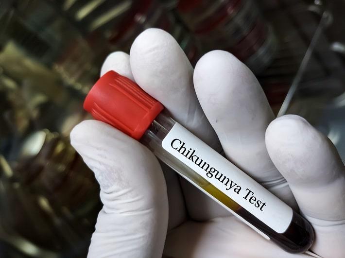 יד אוחזת במבחנת דם של בדיקת צ'יקונגוניה
