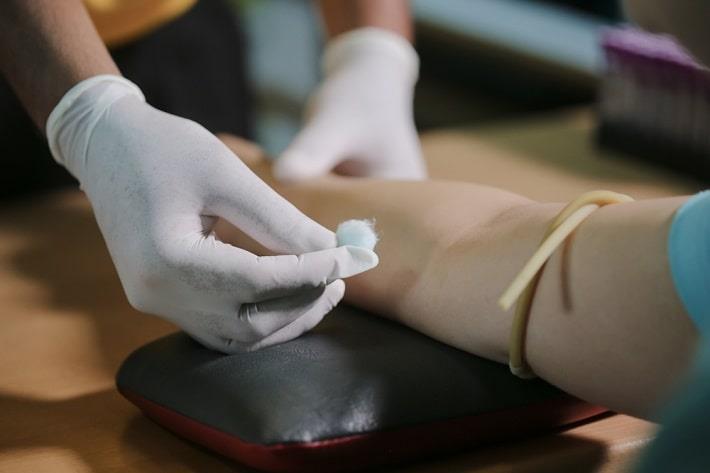 חיטוי זרוע של מטופלת לקראת בדיקת דם של רמת מטבוליט 6-TG של אימורן בדם 