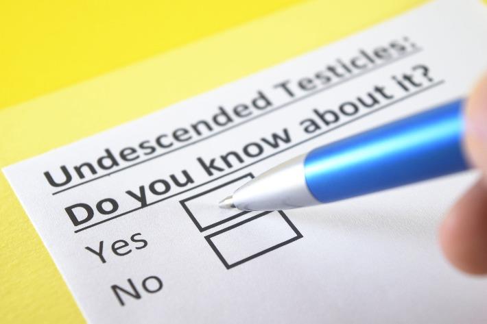 שאלון: האם אתה יודע מה זה אשך טמיר