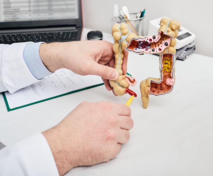 רופא מסביר על דגם של מערכת העיכול מהו ניתוח תוספתן