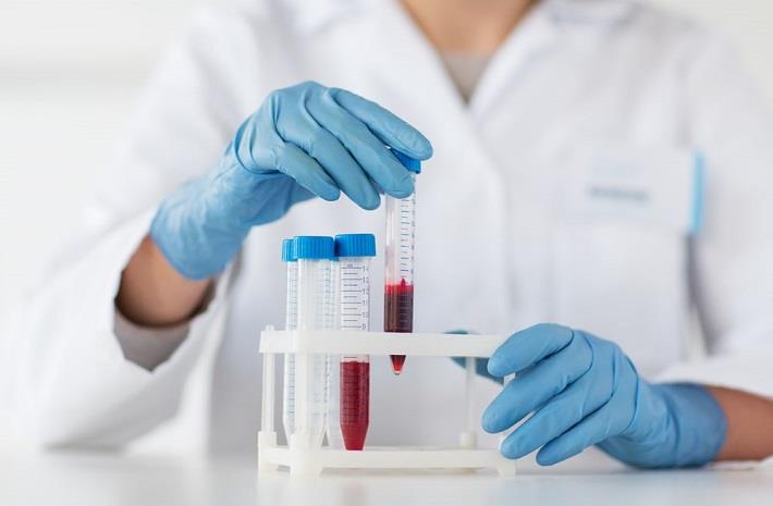 מבחנות עם דם לצורך בדיקות ביוכימיות