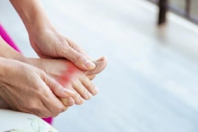 רגל עם סימפטומים של גאוט, קאנאקינומאב (אילאריס) לטיפול במגוון תסמונות ראומטיות