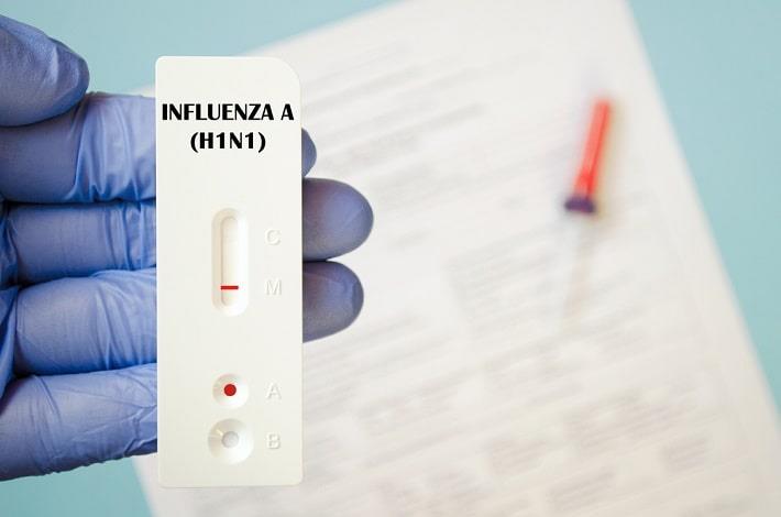 יד אוחזת בבדיקת שפעת H1N1 (שפעת החזירים) 
