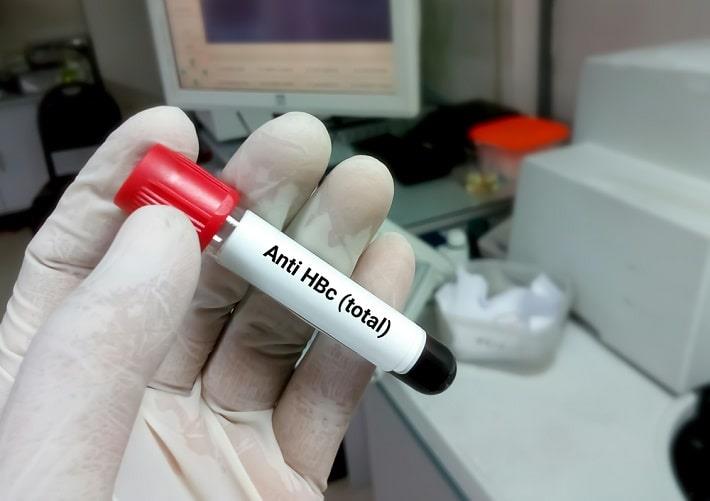 יד אוחזת במבחנת דם של בדיקת נוגדנים כנגד אנטיגן הליבה של הפטיטיס  B