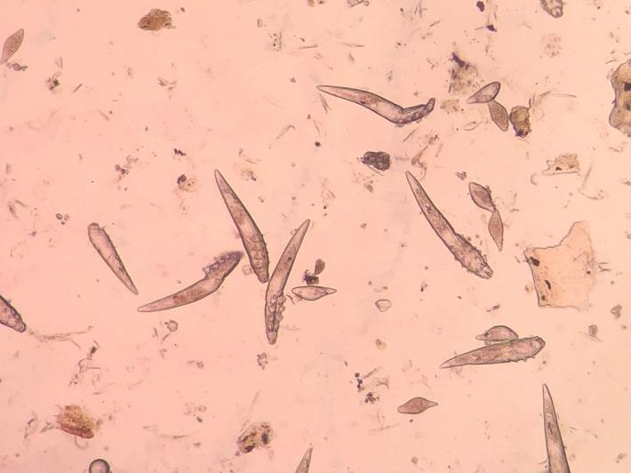 תצלום מיקרוסקופי של טפילים בבדיקת דמודקס