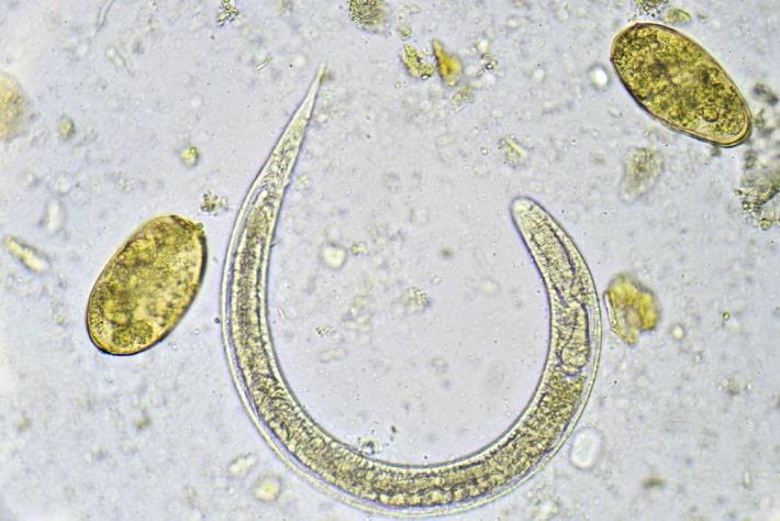 צילום מיקרוסקופי של תולעת סטרונגילואידיס, בדיקת נוגדנים סטרונגילואידים 