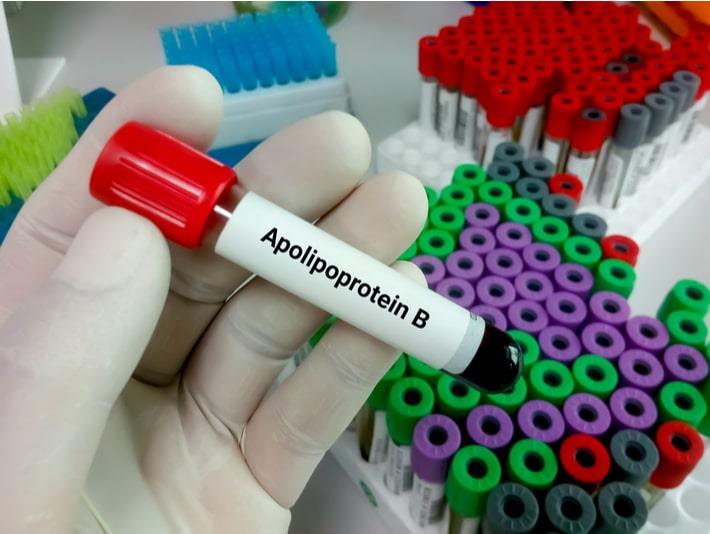 יד עם כפפה מחזיקה מבחנה עם כיתוב של בדיקת אפוליפופרוטאין B על רקע מבחנות נוספות