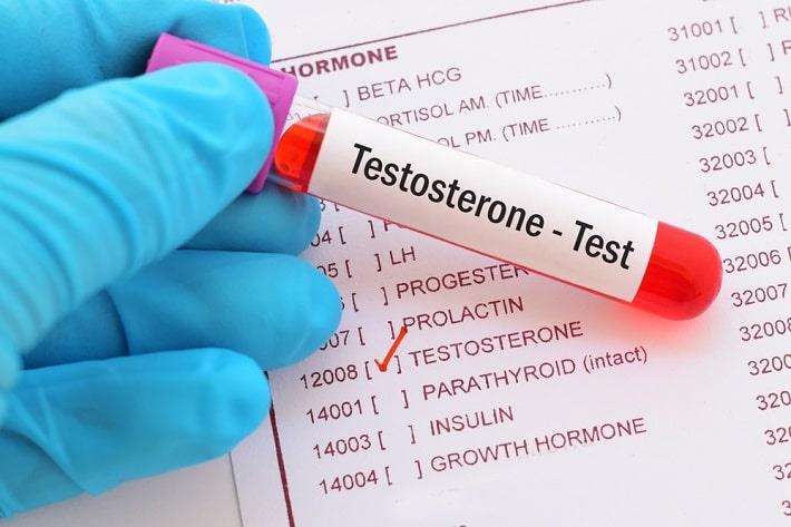 מבחנה עם דם לאחר בדיקת טסטוסטרון זמין בדם, על רקע גיליון בדיקות