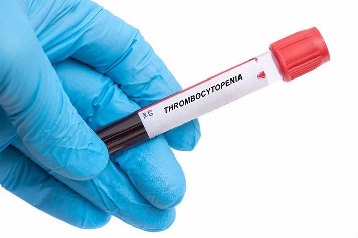 מבחנה עם דם לאחר בדיקת נוגדני HIT לצורך גילוי תרומבוציטופניה 