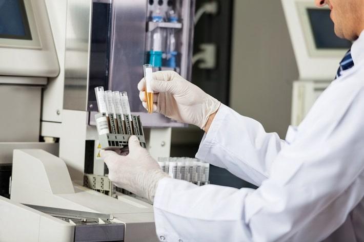 טכנאי במעבדה מחזיק מבחנה עם בדיקת מוקופוליסכרידים בשתן