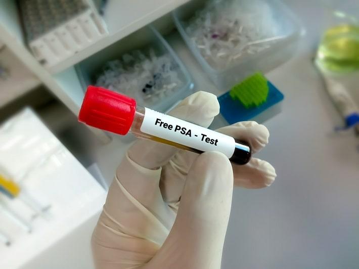 יד עם כפפה אוחזת במבחנת דם שעליה כתוב בדיקת PSA חופשי 