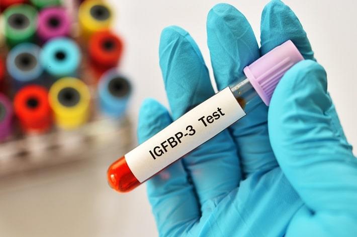 יד אוחזת במבחנה עם דם של בדיקת הורמון גדילה IGFBP3