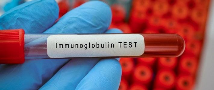 יד אוחזת במבחנה עם דם של בדיקת אימונוגלובולינים 