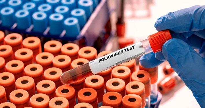 יד אוחזת במבחנה עם דם של בדיקת נוגדנים לפוליו