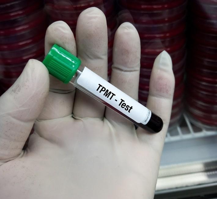 יד אוחזת במבחנה עם דם של בדיקת פעילות האנזים TPMT