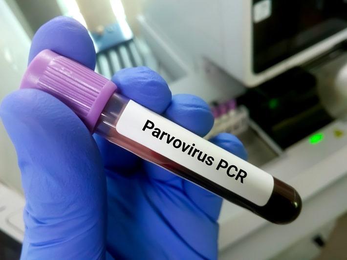 יד אוחזת במבחנת דם של בדיקת פרוו-וירוס B19