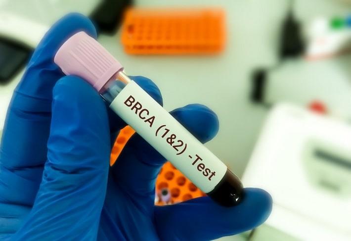 יד אוחזת במבחנת דם של בדיקת רצף גנטי BRCA  