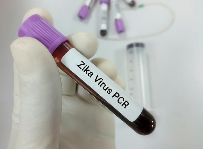 יד אוחזת במבחנת דם של בדיקת PCR לזיקה בדם 