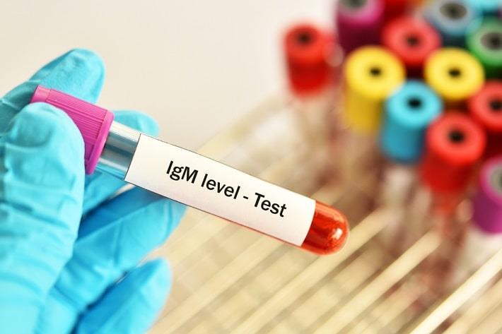 יד אוחזת במבחנת דם של בדיקת IgM לצ'יקונגוניה 
