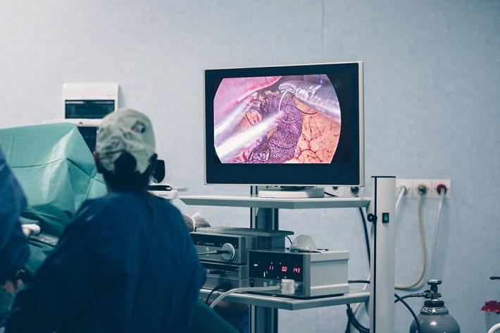 כירורגית בריאטריה מחדירה אנדוסקופ ומתבוננת במוניטור בזמן הצרת קיבה ללא ניתוח