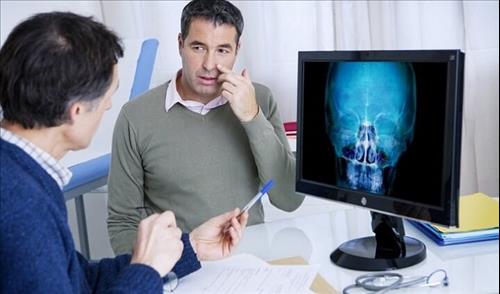 מטופל נוגע בסינוסים מול מסך עם צילום רנטגן ורופא אף אוזן גרון (אא"ג)